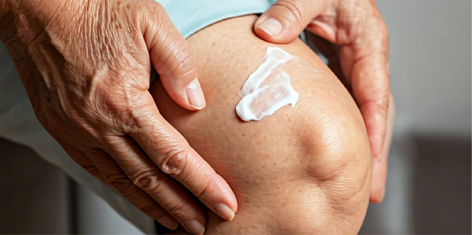Osteoarthritis_Management 1