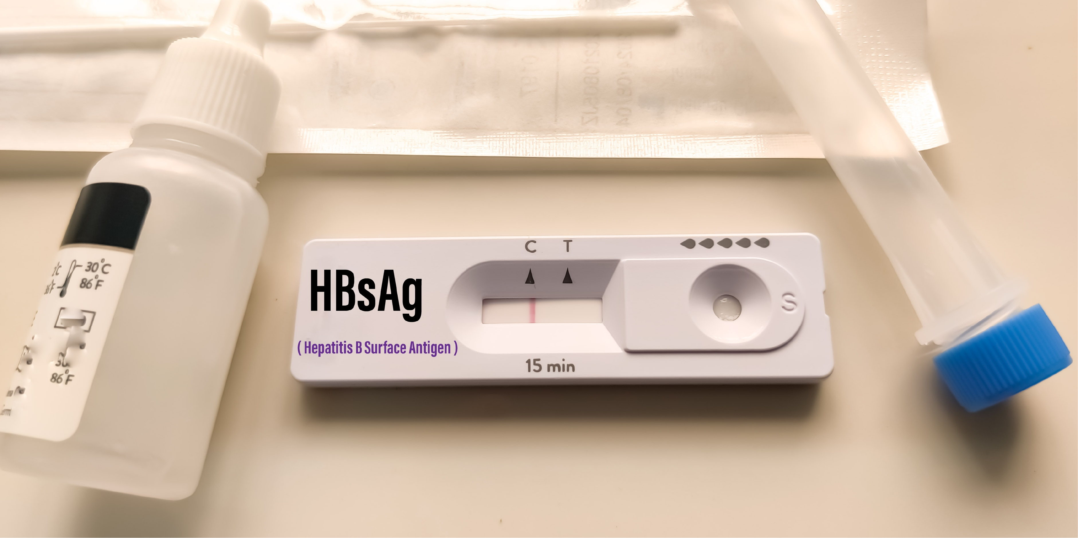 Hepatitis B_Diagnosis